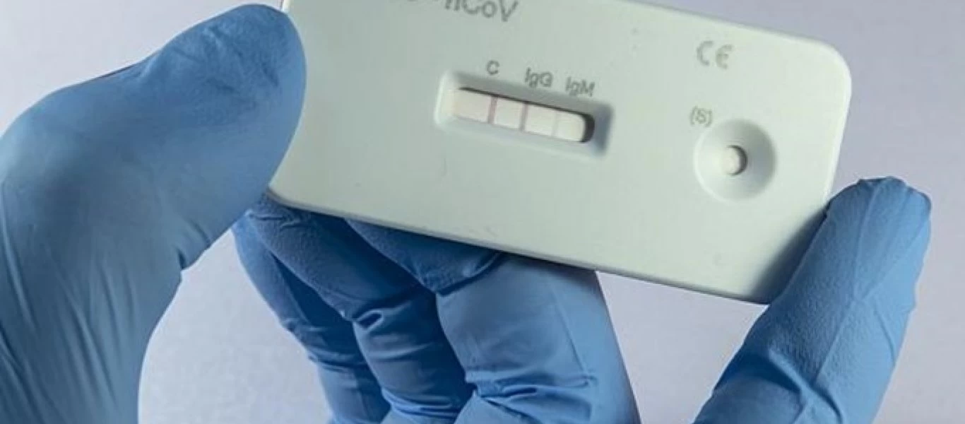 Ο λόγος που δεν πρέπει να κάνετε τεστ αντισωμάτων μετά τον εμβολιασμό σύμφωνα με τους ειδικούς